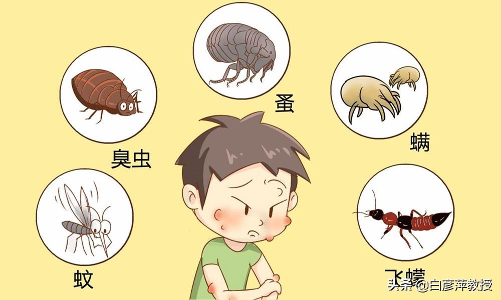 灭跳蚤杀跳蚤服务公司_灭跳蚤批发_灭跳蚤公司哪家好