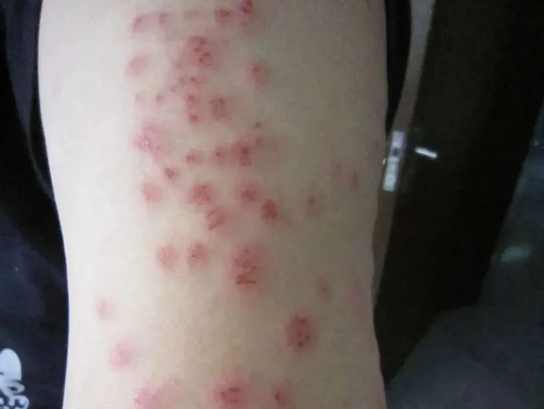 杀虫剂杀臭虫有效果吗_杀臭虫药剂_灭臭虫杀虫剂