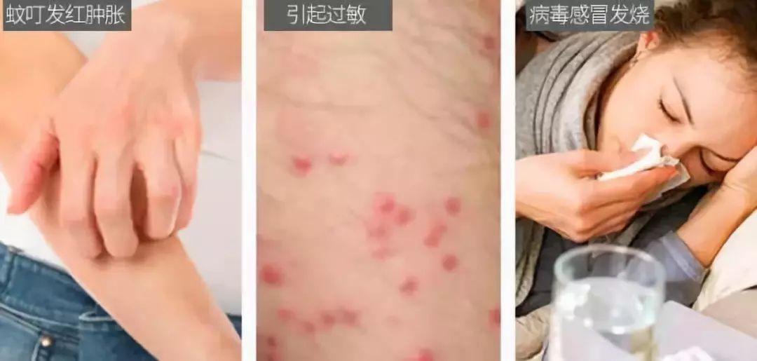 灭蚊子神器第一名_灭蚊子神器有用吗_灭蚊神器多少钱一个