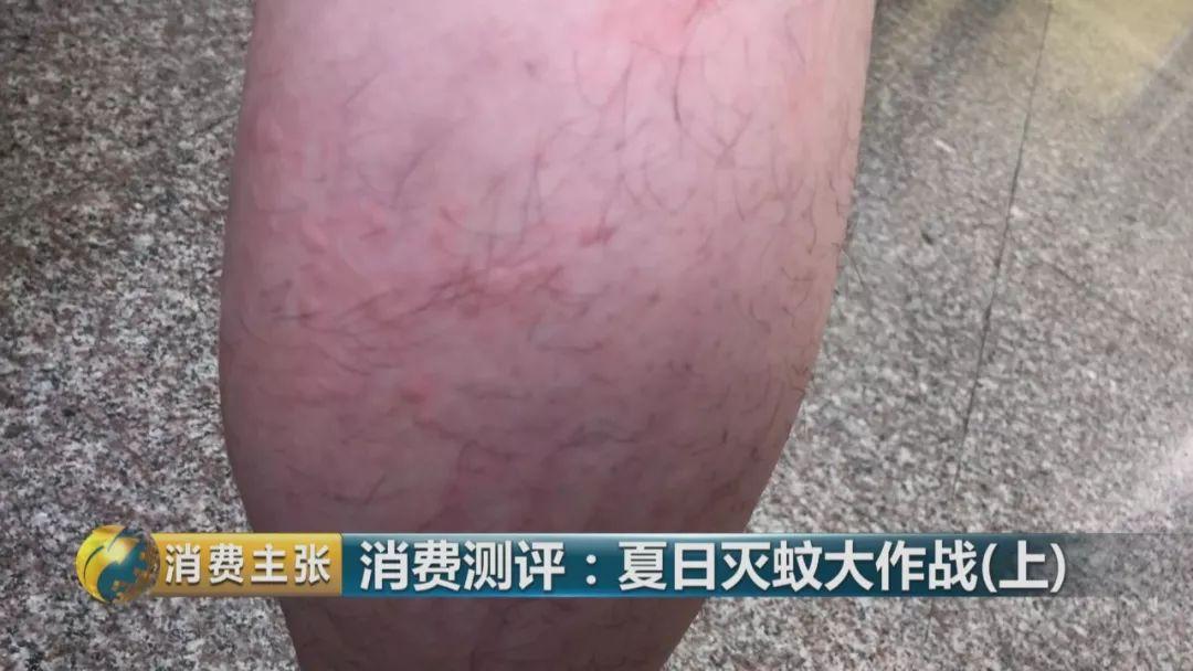 哪个牌子的灭蚊灯效果好_灭蚊灯哪个牌子好用有效_灭蚊灯牌子